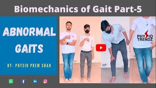 Antalgic gait Hemiplegic gait All Abnormal Gait Demonstration Gait biomechanics [upl. by Ojibbob270]