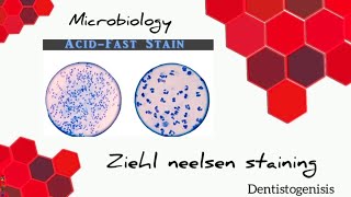 Ziehl Neelsen staining  Acid Fast staining microbiology 2ndyear BDS [upl. by Katha]