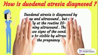 Duodenal atresia  My Wy Radiology [upl. by Geerts]