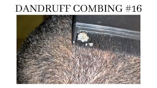 Dandruff combing 16 [upl. by Bolan]