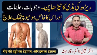 Curvature of Spine ریڑھ کی ہڈی کا ٹیڑھا پن Homeopathic Treatment Causes Symptoms  hindi  urdu [upl. by Kenweigh628]