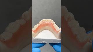 Lower Posterior Flexi Partial EnvisiontecMain envisiontec lsk121shorts dentist teeth [upl. by Meehahs]