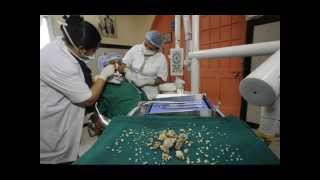 New World Record Surgeons Remove 232 Teeth From a Indian Teenager [upl. by Coriss731]