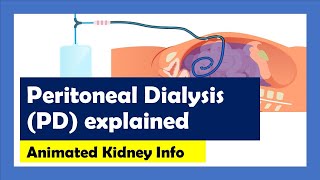 Peritoneal Dialysis explained [upl. by Chris]