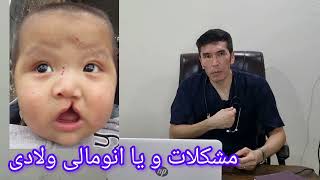 انومالی ولادی یا Congenital anomaly [upl. by Les442]