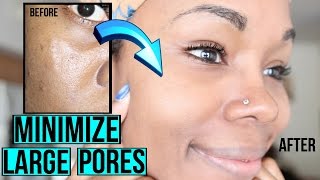 How to Get Rid of Large Pores LIKE A BOSS  Easy Regimen amp AT HOME REMEDIES [upl. by Sitoel400]