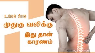 Causes of Lower Back Pain  Reasons medication treatment and home remedies  Tamil Health Tips [upl. by Wallis]