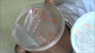 Técnicas básicas de Microbiología Morfología de la bacteria Streptomyces griseoaurantiacus [upl. by Oiznun334]