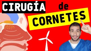 ✅ TURBINOPLASTIA Riesgos complicaciones y postoperatorio de la CIRUGÍA DE CORNETES👃 [upl. by Markos]