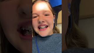 Braces kidslearning kidsfun [upl. by Dominik]