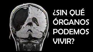 ¿SIN QUÉ ÓRGANOS PODEMOS VIVIR [upl. by Nitas41]