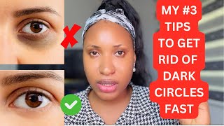 How To Get Rid Of Dark Circles Eyes Dark Circles Fast Remedies [upl. by Mildred529]