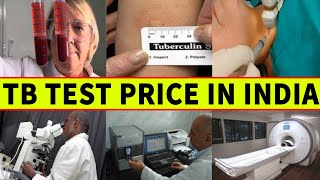 TB Test Price in India  भारत में टीबी टेस्ट की कीमत  Updated [upl. by Mandle]