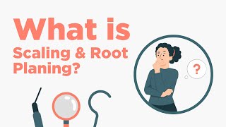 Scaling amp Root Planing  Everything You Need to Know [upl. by Aninahs]