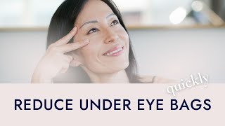 How to Reduce Bags Under Eyes Quickly [upl. by Lossa]