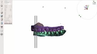 MeshMixer Articulation with Excursive Movements [upl. by Mclaurin480]