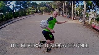 LEARN SKILLS  The Reverse Dislocated Knee [upl. by Erlewine149]