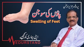 Urdu پاؤں کی سوجن  Swelling Feet  Leg Swelling  Medurstand by Prof Aziz ur Rehman [upl. by Vasily801]