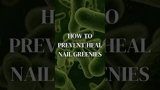 how to preventheal nail greenies nailtipsandtricks nailhealth healthynails shadedbyshanell [upl. by Roanna]