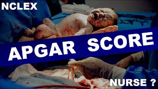 APGAR SCORE  How to check APGAR score  Apgar score assessment  Apgar score newborn [upl. by Langill751]