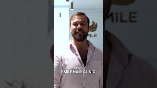 Hair Transplant Results  After Smile Hair Clinic [upl. by Nevek]