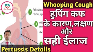 Whooping Cough  Pertussis हुपिंग कफ किसे हो सकता है ईलाज क्या है पूरी जानकारी। [upl. by Aleac28]