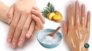 How To Remove Wrinkles From Hands Naturally in 2 Days [upl. by Elaina]