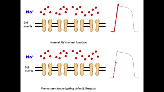 Mechanism of Brugada in a nutshell English Version [upl. by Purpura565]