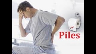 மூல நோயிலிருந்து எளிதாக விடுபட  Piles Treatment details in Tamil [upl. by Pegasus]