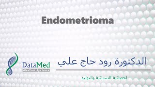 محاضرة دكتورة رود حاج علي Endometrioma [upl. by Jenelle]