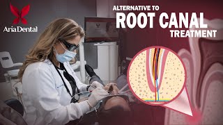 Alternative to Root Canal Treatment  Aria Dental  Maryam Horiyat DDS [upl. by Ayanaj]