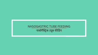 Nasogastric tube feeding [upl. by Tala935]