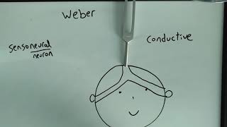 Weber Test made easy SensoneuralConductive hearing loss USMLE [upl. by Ultun]