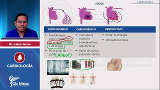 Shock TTO INDICE DESCRIPCIONMANEJO SEGUN TIPOFLUIDOTERAPIAIONOTROPIOS CARDIOLOGÍA QX MEDIC [upl. by Augustus]