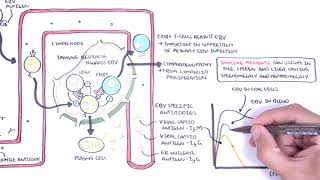 Epstein Barr Virus and Infectious Mononucleosis pathophysiology investigations and treatment [upl. by Suzy159]