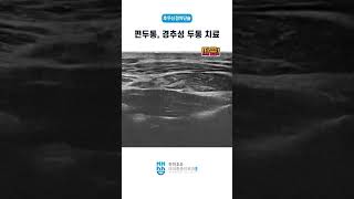 편두통 경추성 두통 치료Treatment of headache [upl. by Voe224]