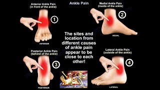 Ankle Pain  Everything You Need To Know  Dr Nabil Ebraheim [upl. by Reffinnej]