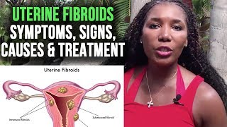 Uterine Fibroids Symptoms Signs Causes and Treatment [upl. by Aisela449]