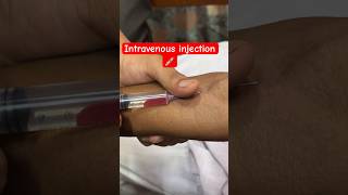 intramuscularinjection ivcannulation trending cannula hospital subscribe SMpharmacy [upl. by Sperry151]