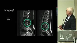 Spondylolysis amp Spondylolisthesis  Wally Krengel MD [upl. by Alemrac]