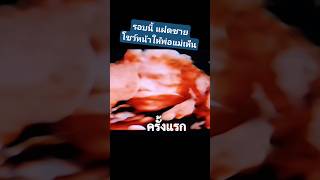 ครั้งแรก​ เห็นหน้าเหน่งน้อย​ เมย์น้อยปิดหน้า​ 🩷🩵 twinbabies [upl. by Alban]