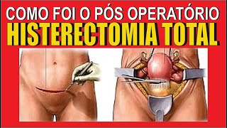 Pós Operatório da Histerectomia Total  minha recuperação [upl. by Rooke]