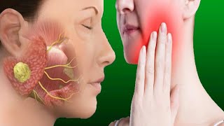 Salivary Gland Infection Causes And Treatment [upl. by Yrrad]