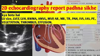 2D echocardiography ki report padhna sikhe [upl. by Ihskaneem]