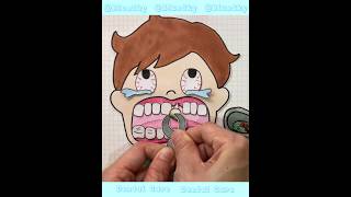 Dental Care🦷Cavity Removal 🦷치과 종이놀이 asmr paperdiy 歯の治療 extract a tooth [upl. by Leila]