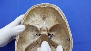 Interior of cranial cavity middle cranial fossa [upl. by Kwok173]