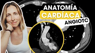 Todo lo que tienes que saber sobre anatomía cardíaca por TC✅ [upl. by Milla442]