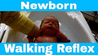 Primitive Reflex  Newborn Baby Walking Reflex Stepping Reflex [upl. by Othilia]