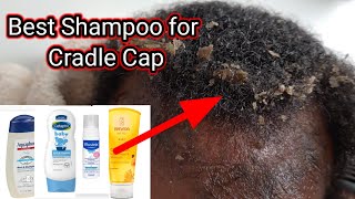 Does Dandruff Shampoo Work on Cradle Cap Severe Cradle Cap Removal Cradle Cap in Babies [upl. by Lewin]