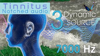 Tinnitus Sound Therapy Natural 7000 Hz Notched Audio with 3 Dynamic Sound Sources [upl. by Michelsen]